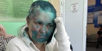Solidarietà alla collega russa Yelena Milashina per le violenze e le inaudite umiliazioni subite